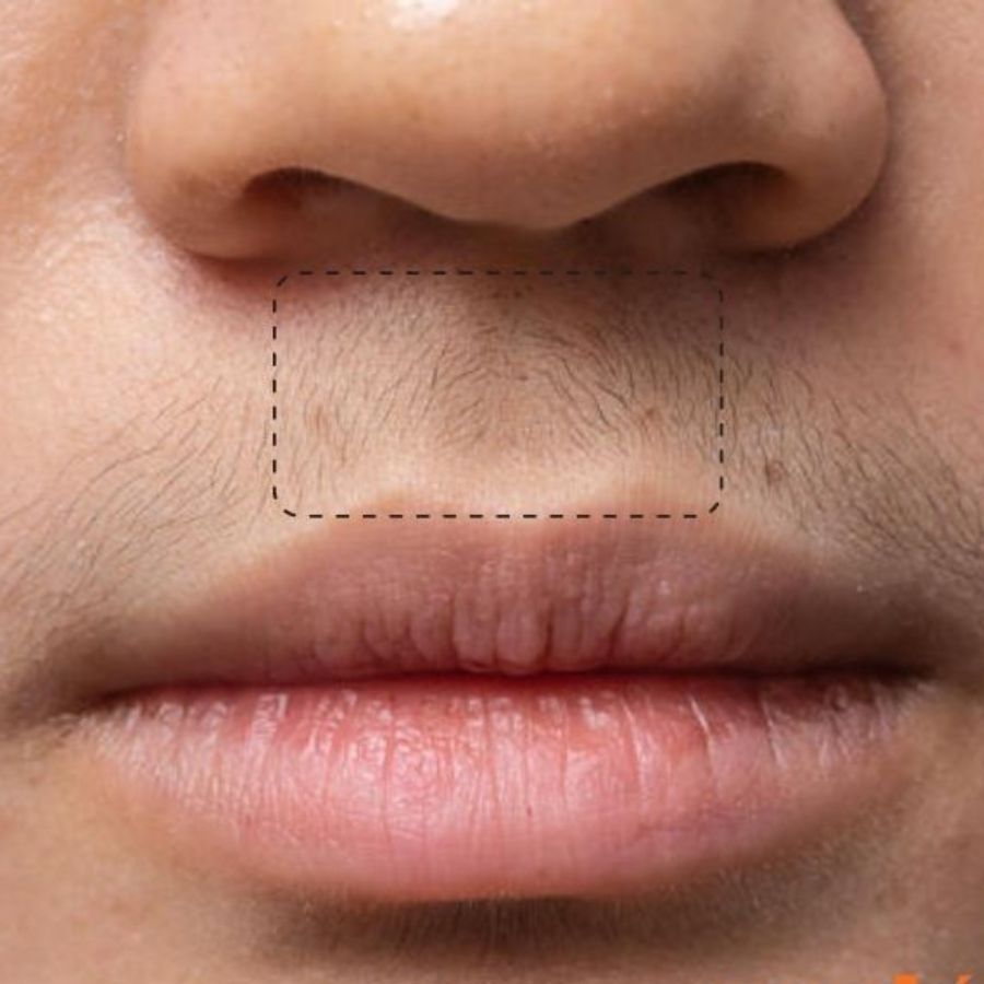 Nhân trung ở đâu? Tướng số nhân trung dài, rộng, sâu, ngắn - Ảnh 5