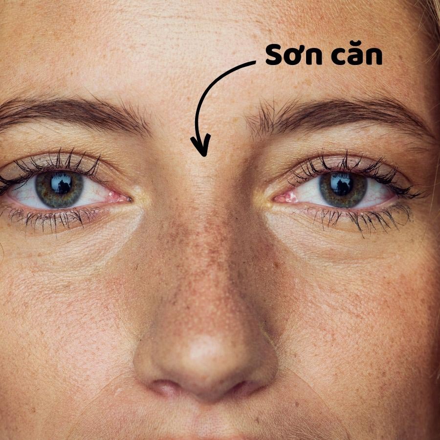 Sơn căn là gì, vị trí? Thế nào là sơn căn khuyết hãm, cao, thấp - Ảnh 1